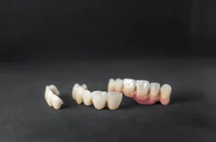 types of tooth crowns